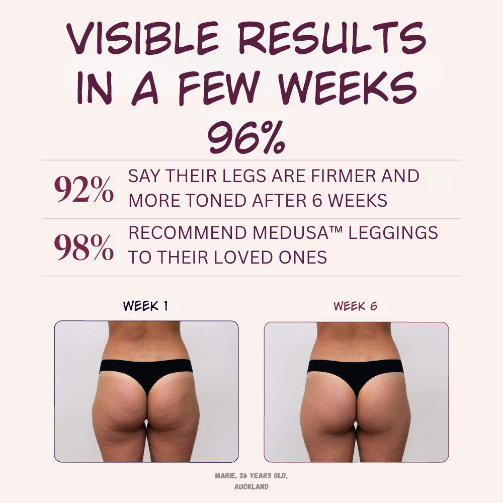 Medusa™ 3D Leggings